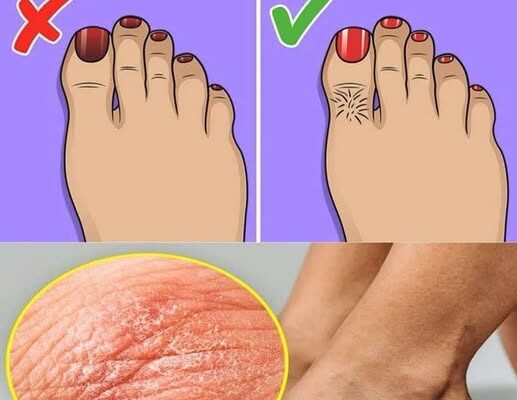 What Your Feet Reveal About Heart Health and Clogged Arteries