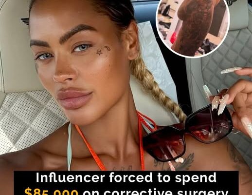 UK Influencer Spends $85K Fixing Butt Implants That “Fell Out”