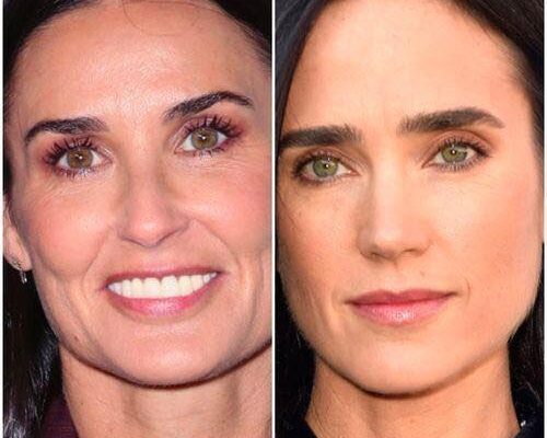 Celebrities who look so alike it’s as if they went to the same plastic surgeon.
