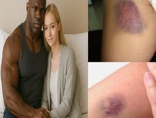 Young woman was hospitalized after being penetrated…See more