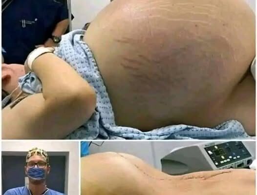 She went into labor, and you won’t believe what they took out of her wo…See More