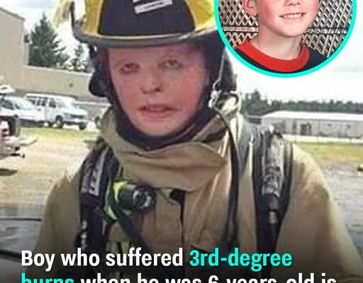 Boy Overcomes 3rd-Degree Burns at Age 6 to Become a Firefighter