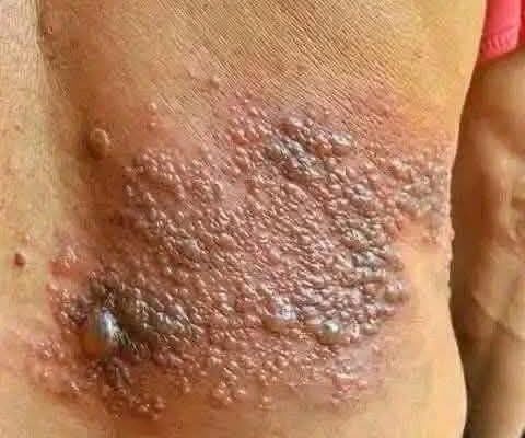 It was itching his body, he thought it was an allergy, but a tough diagnosis… See more