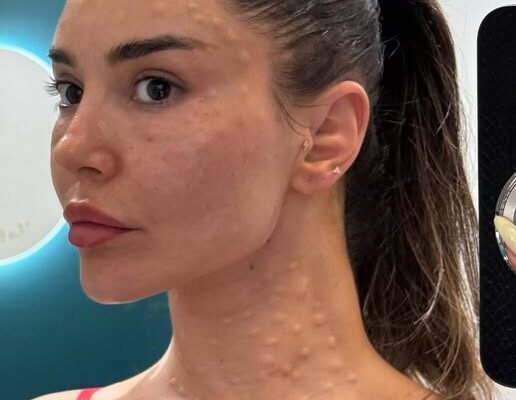 Her body was itchy, he thought it was an allergy