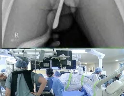 Girl had to be hospitalized for wanting to use a pe..