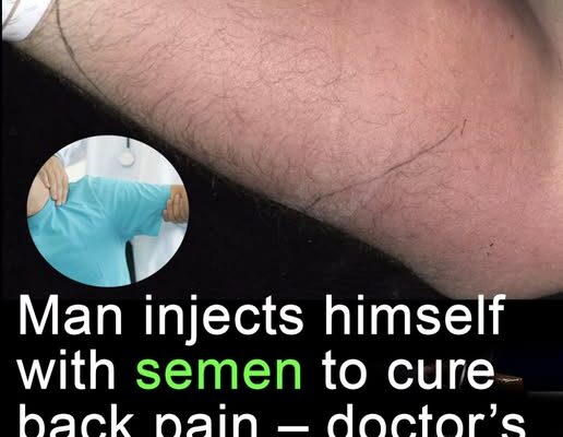 Doctor issues warning after man injects himself with semen to ‘cure back pain’