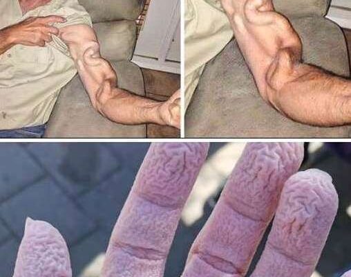 HT1. A Man Goes to Stretch and Ends Up Feeling a Sharp Pain in His Arm, It Was a Case That Shocked Everyone