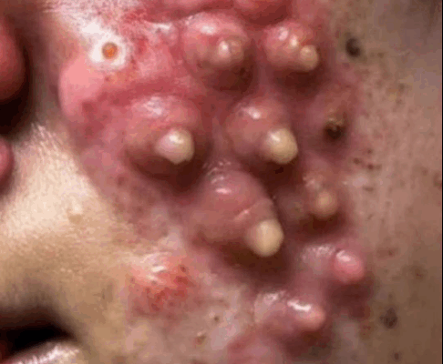 ST. Changes in the Face That Indicate Serious Health Issues (260)