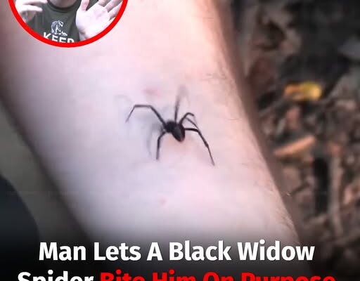 Man Lets A Black Widow Spider Bite Him On Purpose To “Debunk Myths” And The Results Are Shocking