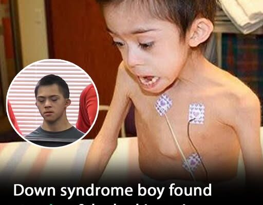 Boy with Down syndrome found starving and locked in attic is reunited with officers who rescued him