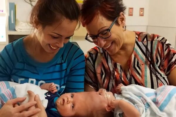 From Impossible Odds to a Miracle: Twin Boys Conjoined at the Head Finally Looked Into Each Other’s Eyes!