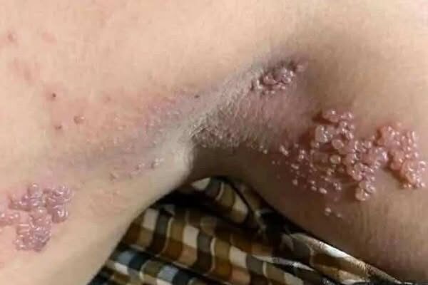 These are the consequences of sleeping co… See more