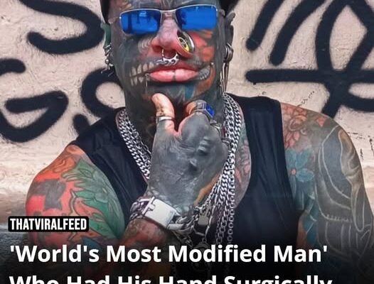‘World’s Most Modified Man’ Explains Why He Surgically Split His Hand In Half