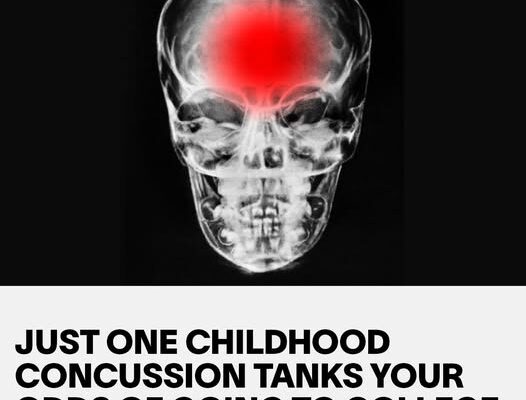 One Childhood Concussion Tanks Your Odds of Going to College