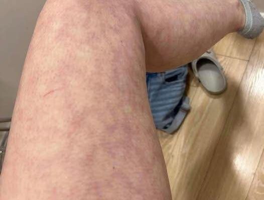 These are the consequences of sleeping with the…See more