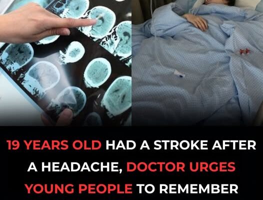 5 Alarming Stroke Warning Signs to Watch for in Young People