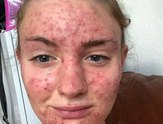 His body was itchy, he thought it was an allergy