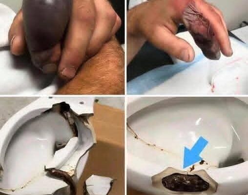 In several regions, while using their toilets, people were attacked by… see the 1st comment