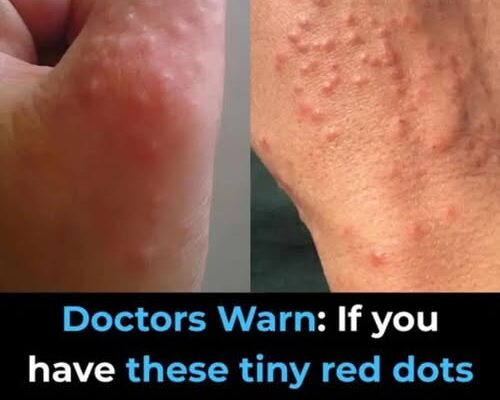 Don’t overlook these small red spots on your arm – They could be important w.arning signs