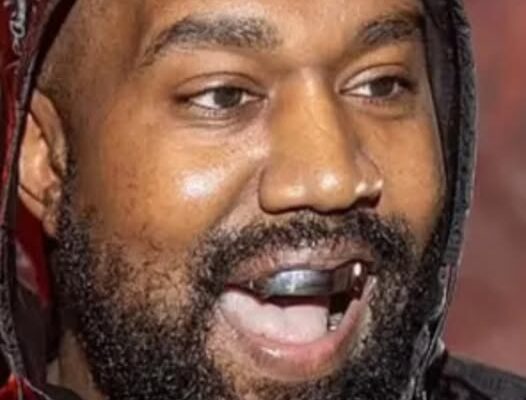 Kanye West Points the Finger at His Dentist and Plans to Take Legal Action