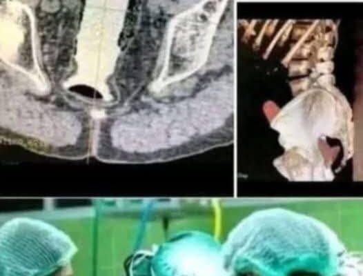 Girl was hospitalized