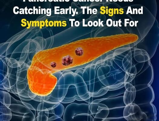 10 Signs of Pancreatic Cancer You Should Never Ignore