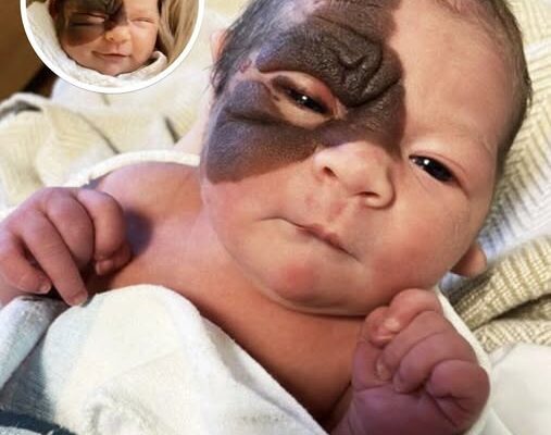 Parents Stunned When They See Newborn Daughter For The First Time, But Here’s What She Looks Like Now