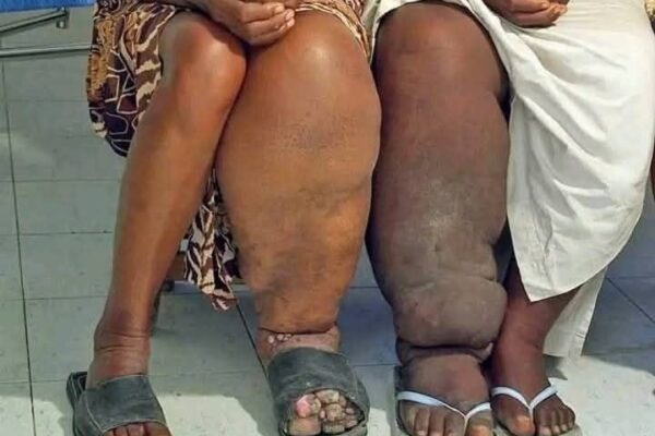 These are the consequences of sleeping with a… See more