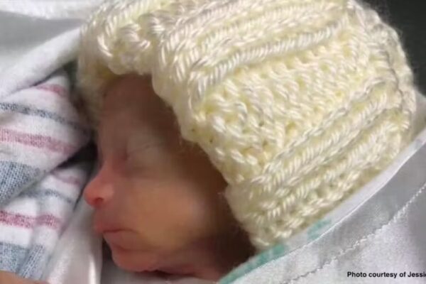 My son was born three days before ‘viability.’ The hospital didn’t try to save him.