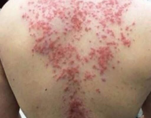 These are the consequences of sleeping with the…