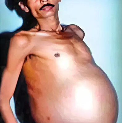 Man stunned to discover what was living inside him all along