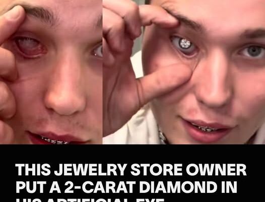 This Jewelry Store Owner Put a 2-Carat Diamond in His Artificial Eye