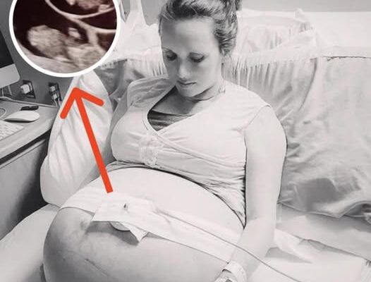 Nurses’ Blood Runs Cold The Moment They See Pregnant Mom’s Ultrasound