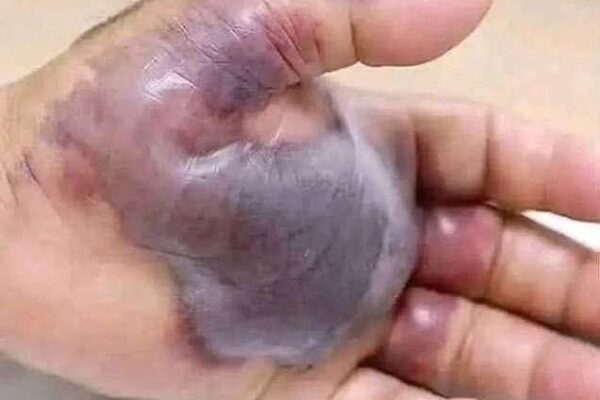 ATTENTION to these first signs of…