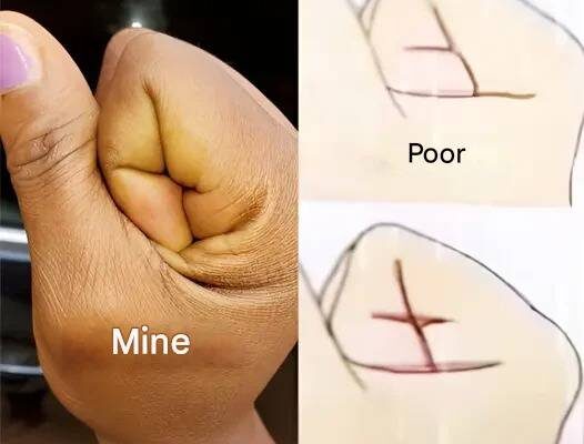 Secrets Hidden in the Lines of the Hand: Revealers of Destiny